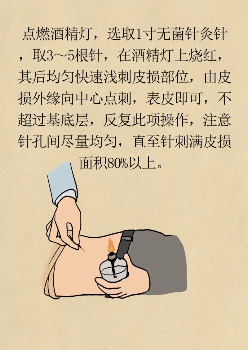 陕西白癜风治疗